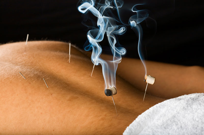 image moxibustion