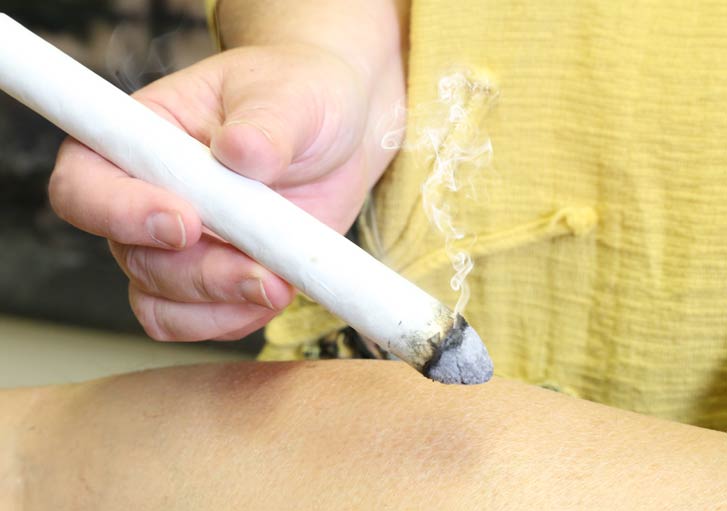 Moxibustion behandeling